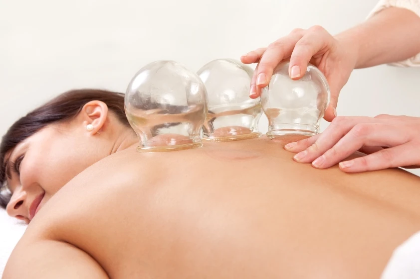 Cupping In Morrisville